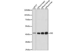 Western blot analysis of extracts of various cell lines, using IVD antibody. (IVD 抗体)