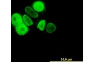 Image no. 2 for anti-Progesterone Receptor (PGR) (AA 1-111) antibody (ABIN598872) (Progesterone Receptor 抗体  (AA 1-111))