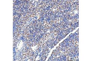 IHC analysis of DDX1 using anti-DDX1 antibody (ABIN7602052). (DDX1 抗体  (AA 562-740))