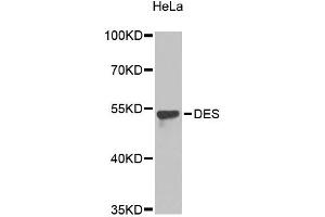 Western blot analysis of extracts of HeLa cells, using DES antibody (ABIN5996882). (Desmin 抗体)