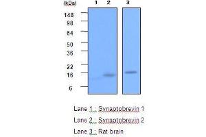 The recombinant Synaptobrevin 1,2(each 20ng) and the extracts of Rat brain(20 ug) were resolved by SDS-PAGE, transferred to PVDF membrane and probed with anti-human Synaptobrevin 2 (1:2,000). (VAMP2 抗体  (AA 1-89))