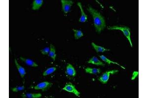 Immunofluorescent analysis of Hela cells using ABIN7151839 at dilution of 1:100 and Alexa Fluor 488-congugated AffiniPure Goat Anti-Rabbit IgG(H+L) (EPH Receptor A4 抗体  (AA 345-545))