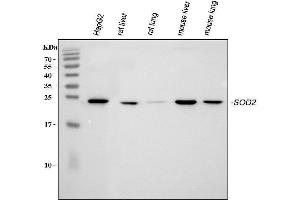 anti-Superoxide Dismutase 2, Mitochondrial (SOD2) (AA 192-222), (C-Term) antibody