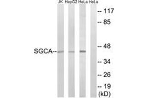 Western blot analysis of extracts from HeLa/HepG2/Jurkat cells, using SGCA Antibody. (SGCA 抗体  (AA 161-210))