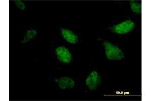 Immunofluorescence (IF) image for anti-Zinc Finger Protein 296 (ZNF296) (AA 1-475) antibody (ABIN949885)