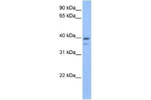 VPS26B antibody used at 1 ug/ml to detect target protein. (VPS26B 抗体)