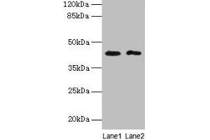 Western blot All lanes: BTBD2 antibody at 6 μg/mL Lane 1: Hela whole cell lysate Lane 2: MDA-MB-231 whole cell lysate Secondary Goat polyclonal to rabbit IgG at 1/10000 dilution Predicted band size: 56, 23 kDa Observed band size: 42 kDa (BTBD2 抗体  (AA 321-525))