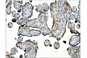 IHC analysis of ANGPT2 using anti-ANGPT2 antibody (ABIN7601450). (Angiopoietin 2 抗体  (AA 357-404))