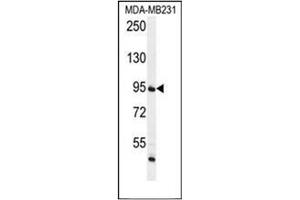 Western blot analysis of FTSJ3 Antibody (Center) in MDA-MB231 cell line lysates (35ug/lane). (FTSJ3 抗体  (Middle Region))