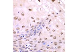 Immunohistochemistry of paraffin-embedded human esophagus using SQSTM1 antibody. (SQSTM1 抗体)