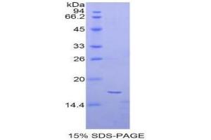 SDS-PAGE of Protein Standard from the Kit (Highly purified E. (alpha Fetoprotein ELISA 试剂盒)