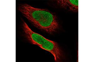 Immunofluorescent staining of human cell line U-2 OS with PVRL1 polyclonal antibody  at 1-4 ug/mL concentration shows positivity in nucleus but excluded from the nucleoli.