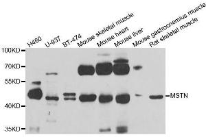 Western blot analysis of extracts of various cell lines, using MSTN antibody.