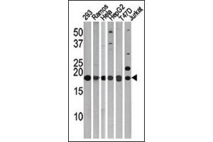 LC3C Antibody (APG8c) Cat. (LC3C 抗体  (N-Term))