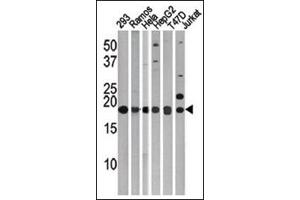LC3C Antibody (APG8c) Cat. (LC3C 抗体  (N-Term))