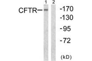 Western blot analysis of extracts from NIH-3T3 cells, using CFTR (Ab-737) Antibody. (CFTR 抗体  (AA 711-760))