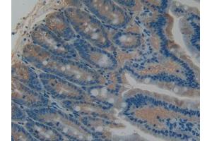 DAB staining on IHC-P; Samples: Rat Intestine Tissue (PLAT 抗体  (AA 311-487))