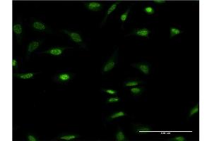 Immunofluorescence of monoclonal antibody to OLIG2 on HeLa cell.