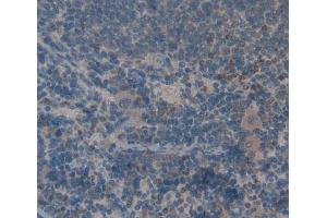 Used in DAB staining on fromalin fixed paraffin- embedded Kidney tissue
