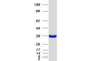 Validation with Western Blot (FCN1 Protein (Myc-DYKDDDDK Tag))