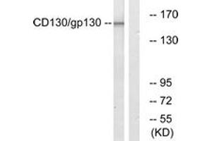 Western blot analysis of extracts from Jurkat cells, using CD130/gp130 (Ab-782) Antibody. (CD130/gp130 抗体  (AA 748-797))