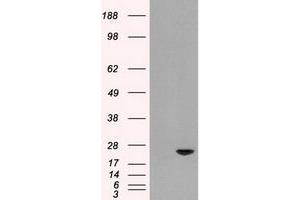 Image no. 1 for anti-Adenylate Kinase 1 (AK1) antibody (ABIN1496514) (Adenylate Kinase 1 抗体)