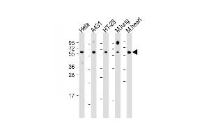 All lanes : Anti-CDC25B Antibody (Center) at 1:1000 dilution Lane 1: Hela whole cell lysate Lane 2: A431 whole cell lysate Lane 3: HT-29 whole cell lysate Lane 4: mouse lung lysate Lane 5: mouse heart lysate Lysates/proteins at 20 μg per lane. (CDC25B 抗体  (AA 331-360))