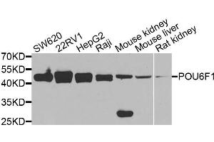 Western blot analysis of extracts of various cell lines, using POU6F1 antibody (ABIN5974401) at 1/1000 dilution. (POU6F1 抗体)