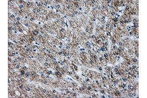 Immunohistochemical staining of paraffin-embedded liver tissue using anti-ATP5B mouse monoclonal antibody. (ATP5B 抗体)