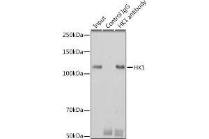 Immunoprecipitation (IP) image for anti-Hexokinase 1 (HK1) antibody (ABIN7267638)