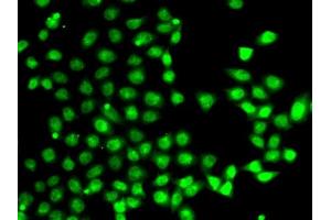 Immunofluorescence analysis of A-549 cells using E antibody (ABIN6127826, ABIN6139905, ABIN6139906 and ABIN6222933). (EAF2 抗体  (AA 1-170))