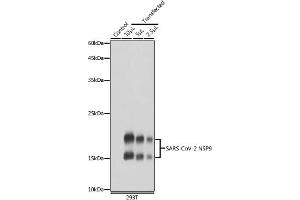 Western blot analysis of extracts of normal 293T cells and 293T transfected with NSP9 Protein, using SARS-CoV-2 NSP9 antibody (ABIN7268509) at 1:5000 dilution. (MHV NSP9 抗体)