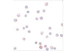 Immunocytochemistry of ZEB1 in HeLa cells with ZEB1 antibody at 20 μg/ml. (ZEB1 抗体  (Center))