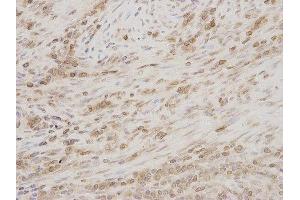 Immunohistochemistry (IHC) image for anti-Thymopoietin (TMPO) antibody (ABIN1875122) (Thymopoietin 抗体)