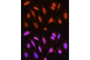 Immunofluorescence analysis of U2OS cells using HSP antibody (ABIN6128040, ABIN6142040, ABIN6142041 and ABIN6223893) at dilution of 1:100. (HSPA2 抗体  (AA 400-639))