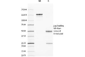 SDS-PAGE Analysis Purified Cytokeratin 7/17 Mouse Monoclonal Antibody (C-46). (Keratin 7/17 抗体)
