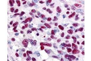Immunohistochemistry (IHC) image for anti-GLI Family Zinc Finger 3 (GLI3) (AA 30-60) antibody (ABIN129623)
