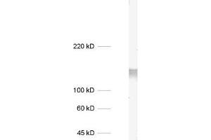 dilution: 1 : 1000, sample: mouse brain homogenate (STXBP5L 抗体)