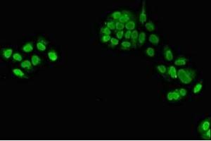 Immunofluorescent analysis of PC-3 cells using ABIN7172035 at dilution of 1:100 and Alexa Fluor 488-congugated AffiniPure Goat Anti-Rabbit IgG(H+L) (TXNL4A 抗体  (AA 1-142))