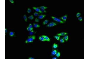 Immunofluorescent analysis of HepG2 cells using ABIN7171798 at dilution of 1:100 and Alexa Fluor 488-congugated AffiniPure Goat Anti-Rabbit IgG(H+L) (SLC26A8 抗体  (AA 414-595))