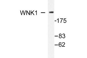 Image no. 1 for anti-WNK Lysine Deficient Protein Kinase 1 (WNK1) antibody (ABIN271862) (WNK1 抗体)