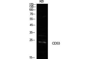 Western Blot (WB) analysis of KB cells using CD53 Polyclonal Antibody. (CD53 抗体  (Internal Region))