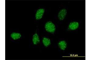 Immunofluorescence of purified MaxPab antibody to ZNF486 on HeLa cell. (ZNF486 抗体  (AA 1-216))