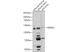 Western blot analysis of extracts of various cell lines, using MORC2 antibody (ABIN7268683) at 1:1000 dilution. (MORC2 抗体  (AA 60-250))