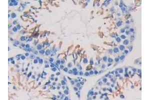 Immunohistochemistry (IHC) image for anti-Nexilin (NEXN) (AA 421-607) antibody (ABIN7443539)