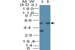 Western blot analysis of VDAC2 in human brain cell lysate in the A) absence and B) presence of immunizing peptide. (VDAC2 抗体  (AA 120-132))