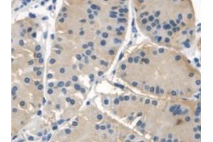 DAB staining on IHC-P; Samples: Human Stomach Tissue (NAIP 抗体  (AA 923-1148))