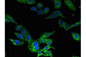 Immunofluorescent analysis of Hela cells using ABIN7146428 at dilution of 1:100 and Alexa Fluor 488-congugated AffiniPure Goat Anti-Rabbit IgG(H+L) (CAMK1 抗体  (AA 166-265))