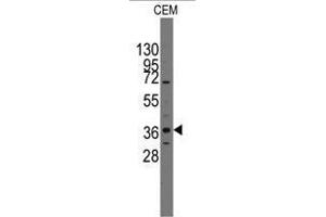 Image no. 1 for anti-Paired-Like Homeodomain 2 (PITX2) (C-Term) antibody (ABIN356913) (PITX2 抗体  (C-Term))