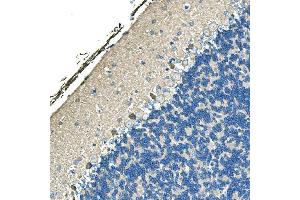 IHC analysis of Ankyrin Erythroid/ANK/ANK1 using anti-Ankyrin Erythroid/ANK/ANK1 antibody (ABIN7599959).